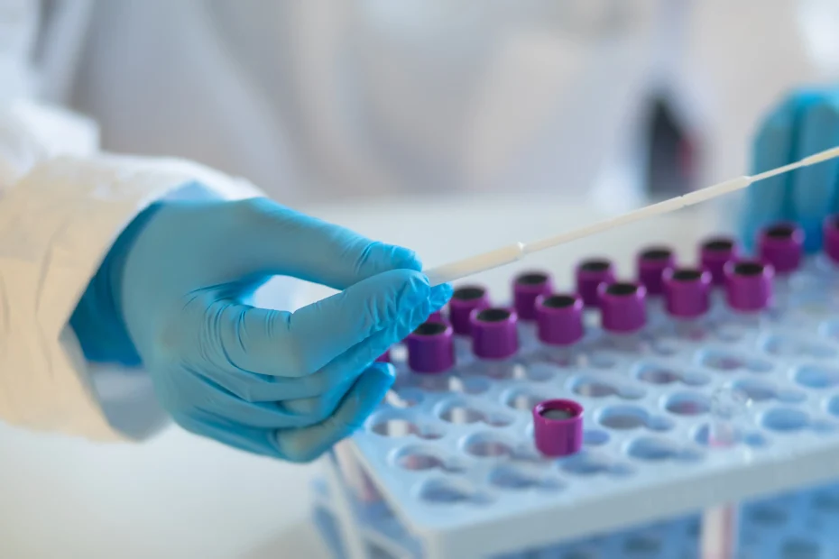 معرفی آزمایشات سلامت و تندرستی آزمایشگاه دنا